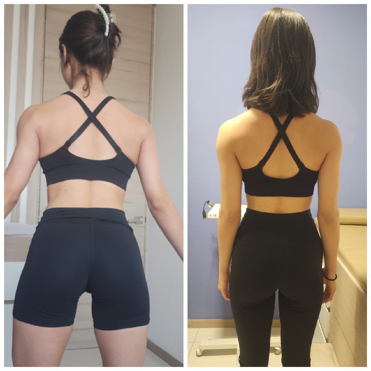 Transformación Mujer Espalda